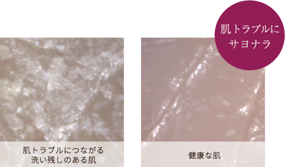 肌トラブルにサヨナラ
