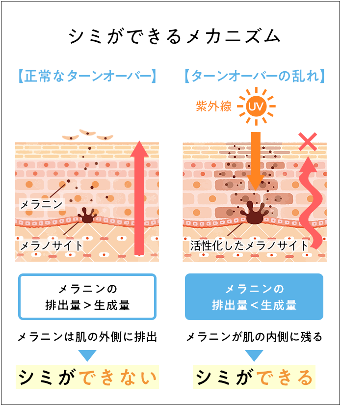 シミができるメカニズム