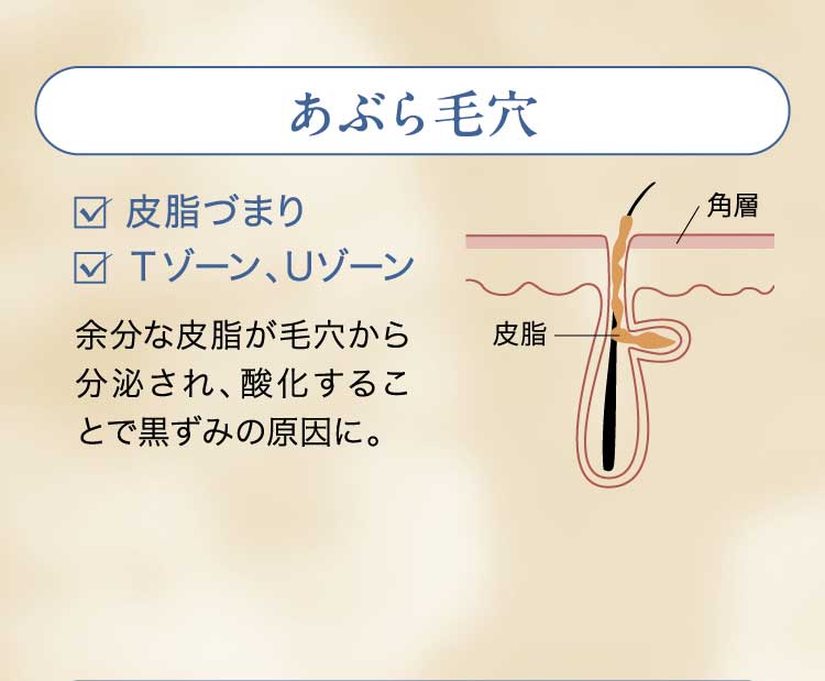 あぶら毛穴