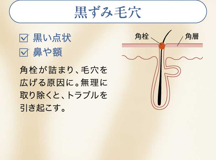 黒ずみ毛穴