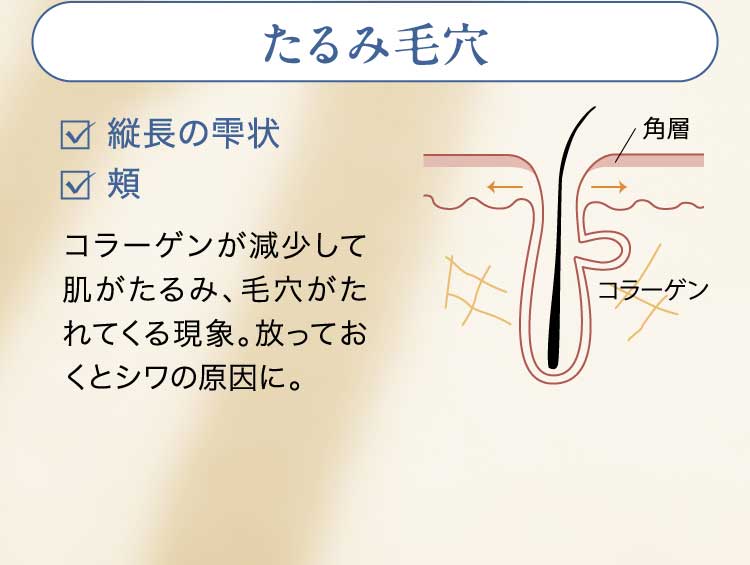 たるみ毛穴